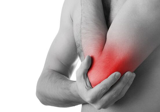 La hinchazón y el dolor agudo en la articulación son signos de la última etapa de la artrosis. 
